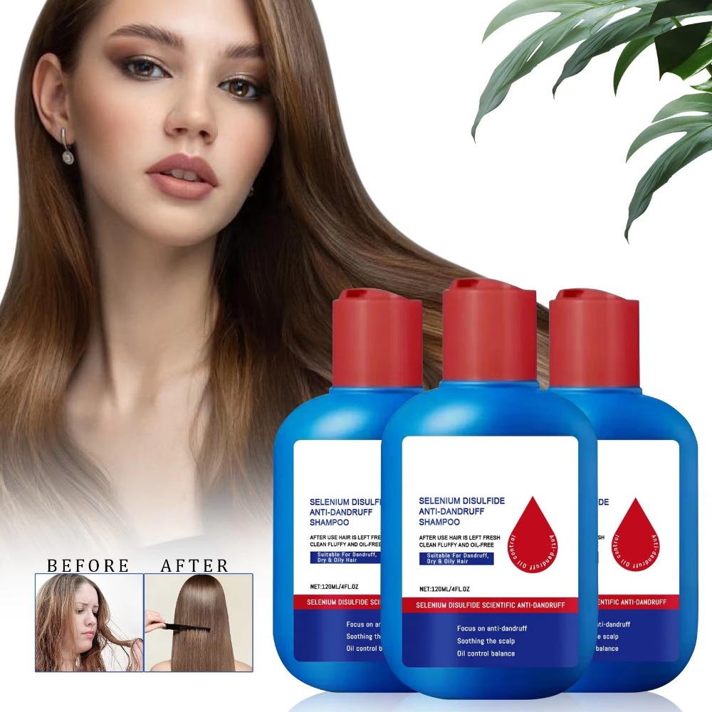 Hair Care Dandruff - Nuovo Shampoo Nipori 120ml per Controllo