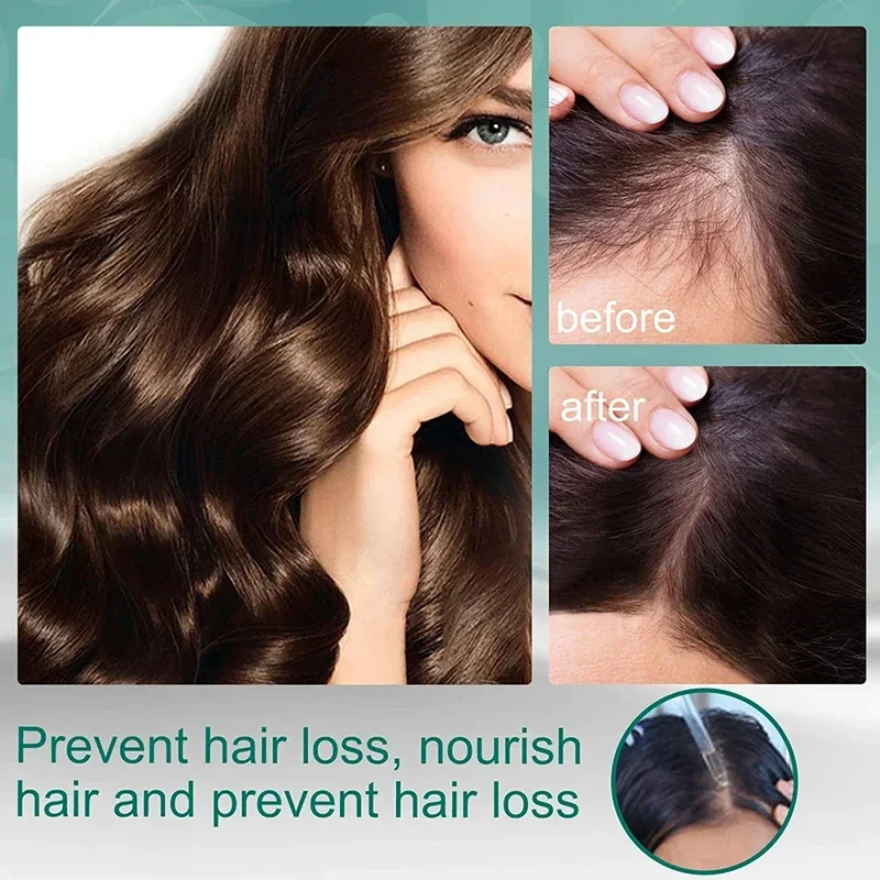 Trattamento liquido quattro er - Hair Care Natural Ingredients recensione e prezzo