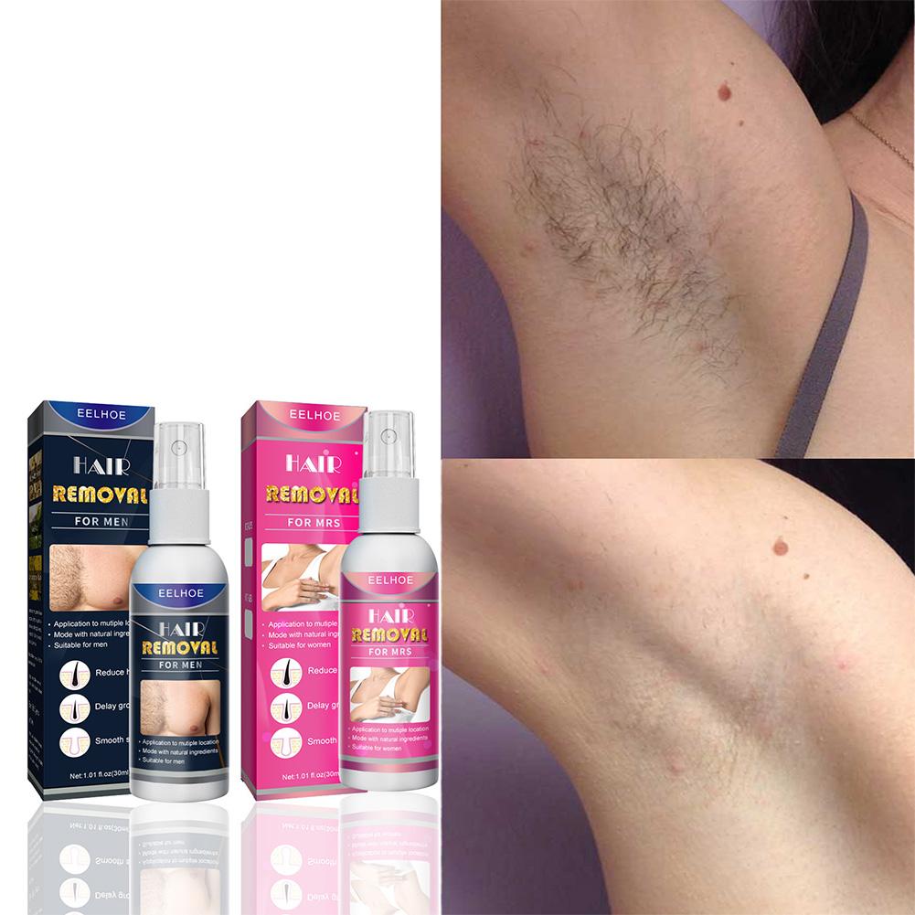 1/2PCS Super Naturale Indolore - Hair Care Lotion recensione e prezzo