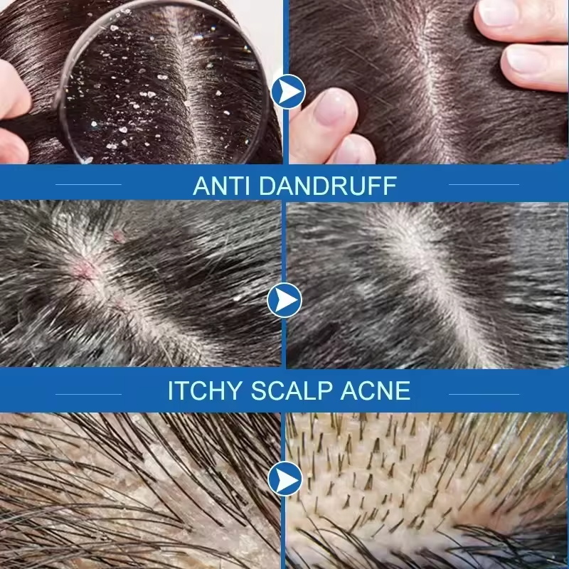 Veloce Antiforfora Trattamento - Hair Care Dandruff recensione e prezzo