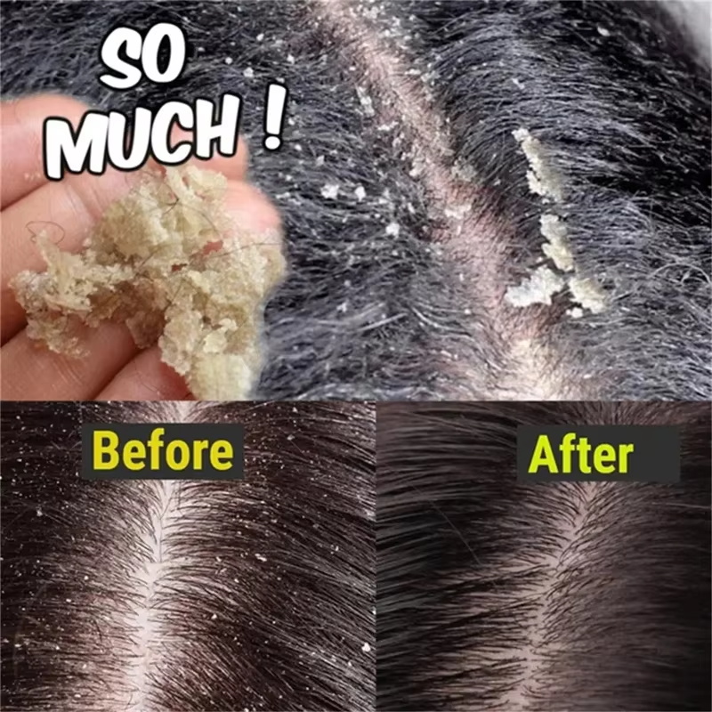 Veloce Antiforfora Trattamento - Hair Care Dandruff recensione e prezzo
