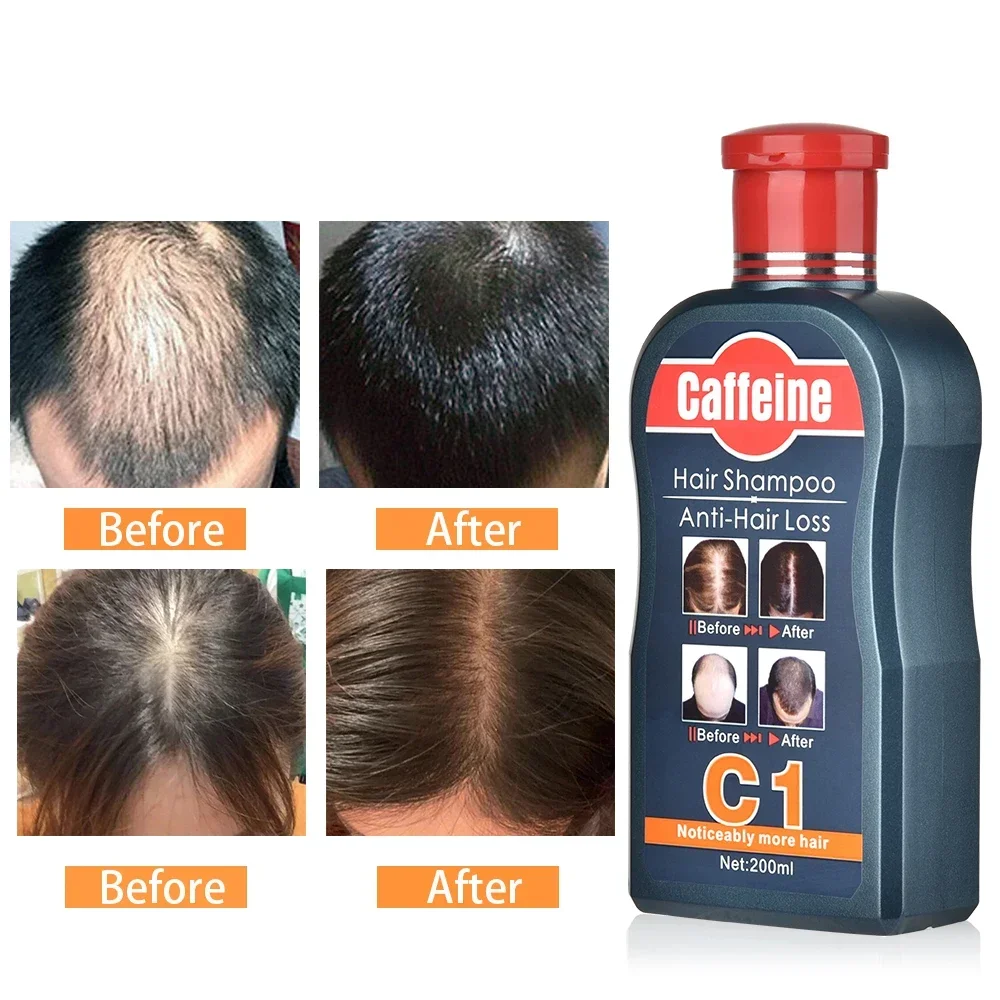 Shampoo da uomo per la crescit - Hair Care Korean Products recensione e prezzo